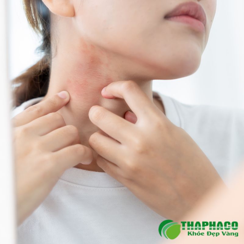 Dị cảm biểu hiện qua nhiều cảm giác khó chịu như tê buốt, châm chích như kim đâm