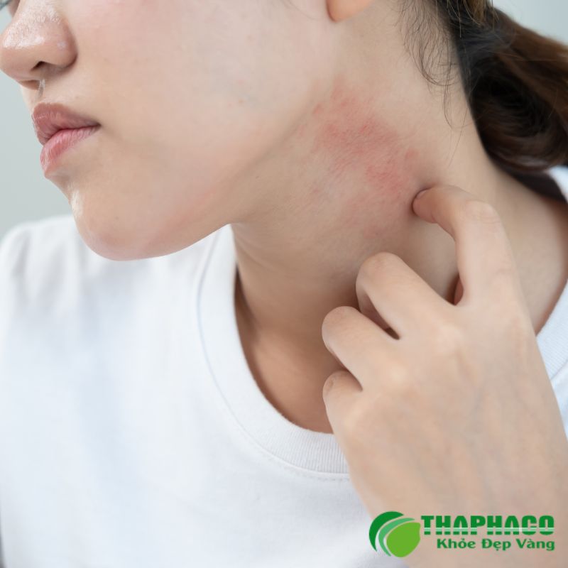 dị cảm là bệnh gì