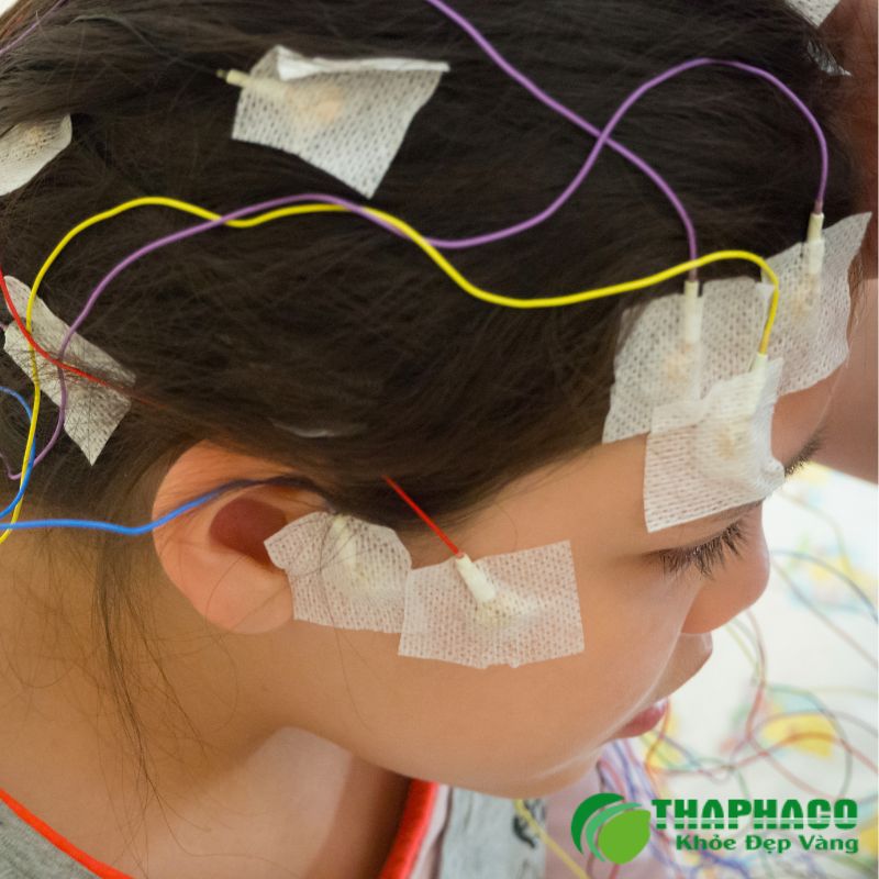 Chẩn đoán động kinh dựa vào điện não đồ, chụp MRI não và xét nghiệm máu