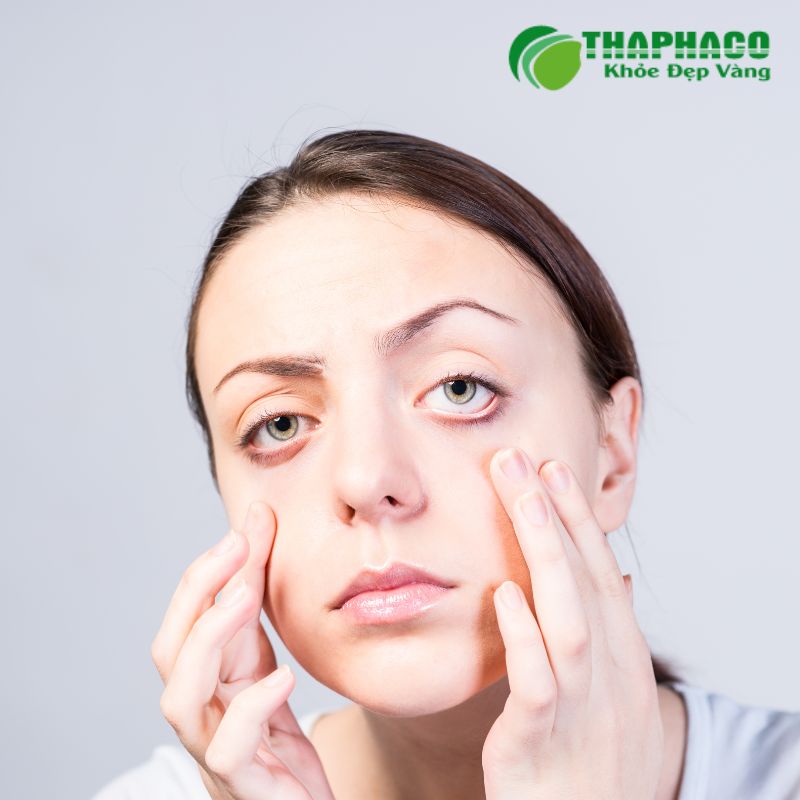 Bệnh nhược cơ phát sinh khi hệ miễn dịch sản xuất kháng thể tấn công các thụ thể acetylcholine