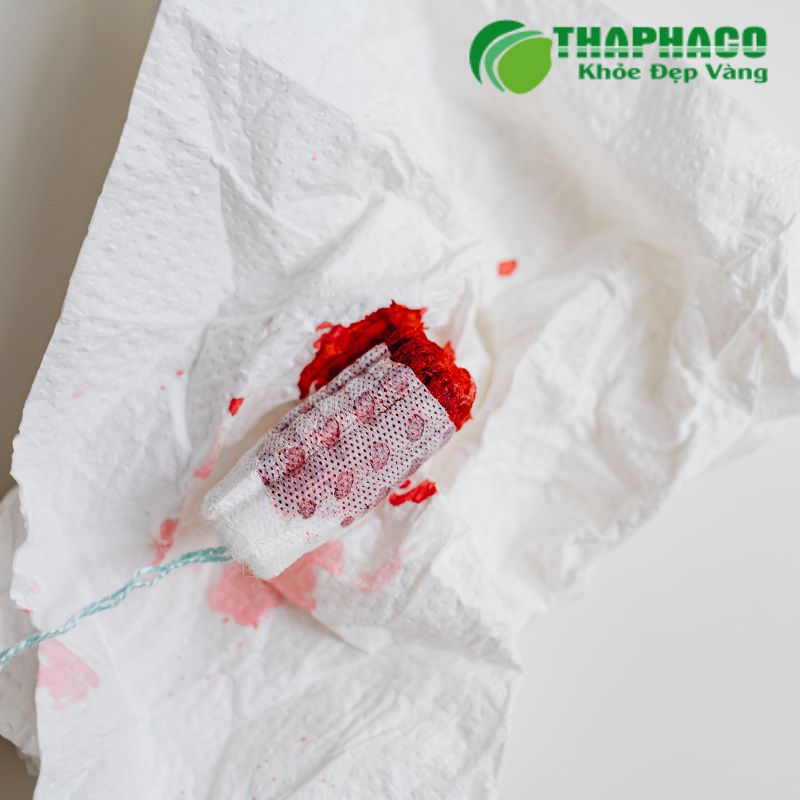 Dấu hiệu và triệu chứng nhận biết nứt kẽ hậu môn