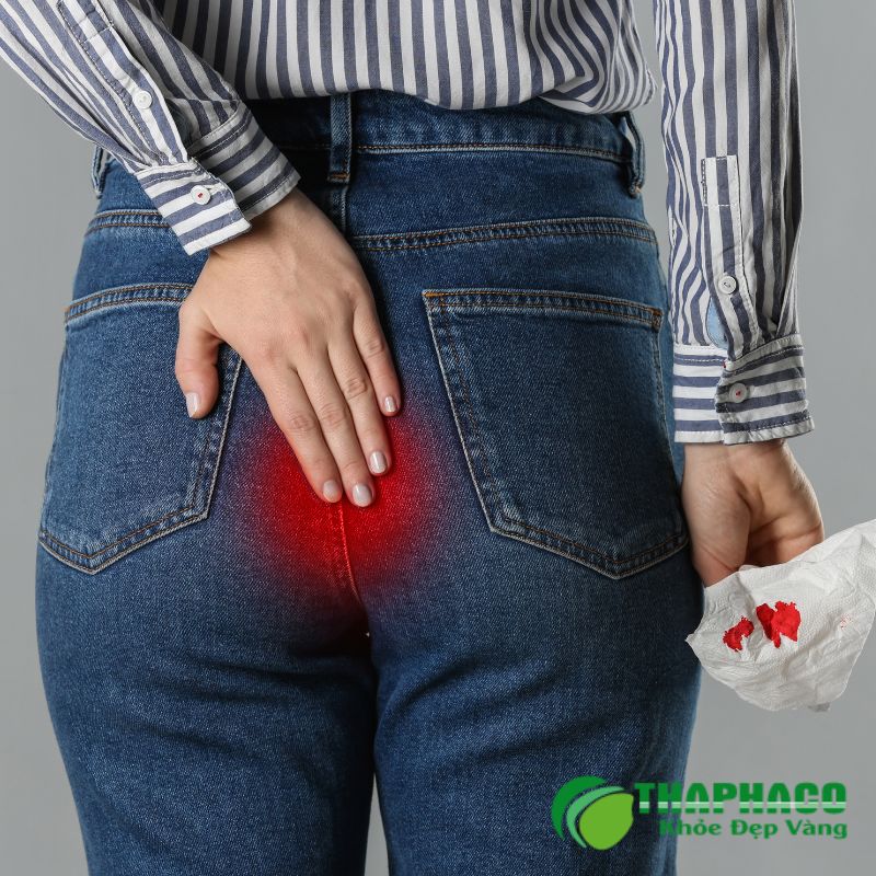 Rò hậu môn là tình trạng nhiễm trùng mãn tính tạo đường hầm bất thường từ ống hậu môn ra da
