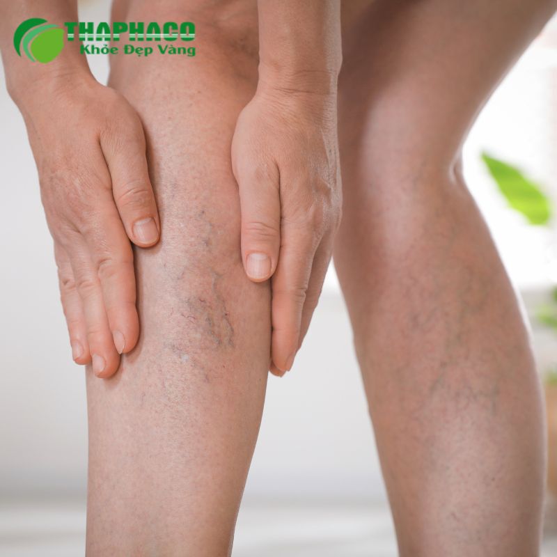 Người lớn tuổi, phụ nữ mang thai, người đứng/ngồi lâu là những người dễ mắc suy tĩnh mạch mạn tính