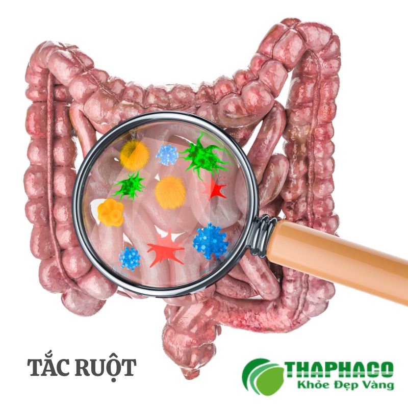 tắc ruột là gì