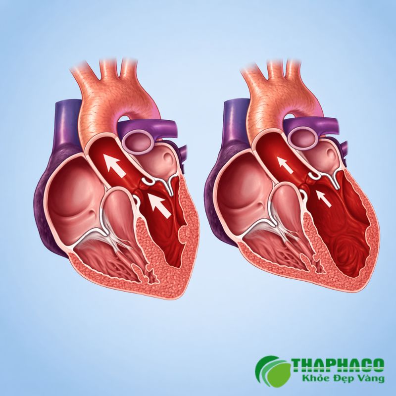 thấp tim là gì