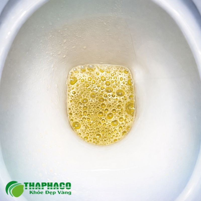 Nguyên nhân chính gây ra protein niệu