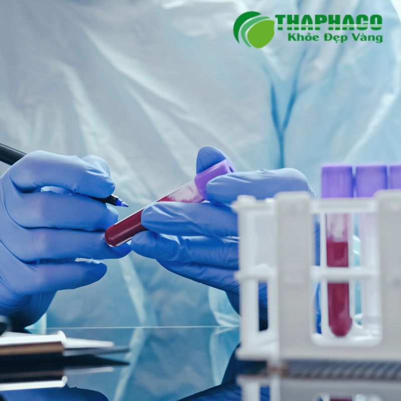 Xét nghiệm máu giúp tìm kiếm dấu hiệu viêm nhiễm, bệnh tự miễn hoặc suy tạng